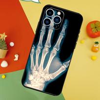 X-Ray Human Anatomy Cover For iPhone 13 12 Mini 11 14 15 16 Pro Max XS X XR 7 8 14 15 16 Plus Phone Case iPhone 15 Pro