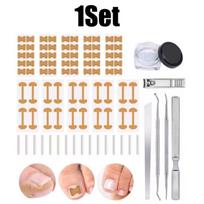 Nail Correction Orthosis Device For Ingrown Toenails Curly Nails Stretching Patch Toe Straightener Tool Pedicure Repair Kit