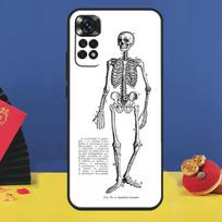 Skeleton Art Case For Xiaomi Redmi Note 14 13 12 11 9 10 15 Pro Plus Redmi 15C 10C 12C 13C 14C 15 Cover Redmi 15C 5G
