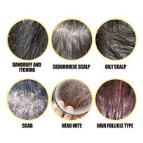 2Pcs Sulfur Shampoo 50g Sulfur Deep Cleansing Shampoo Improves Hair Scalp Condition