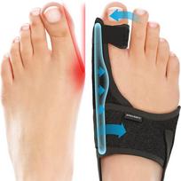 Toe Correction Hallux Valgus Corrector Straightening Big Toe Orthotics Stainless Steel Support Strap Feet Separator Bunion