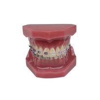 New Orthodontic Teeth Model With Braces Bracket Metal/Ceramic Self-Locking Orthodontic Dental Model Dentistry Treatment For Demo