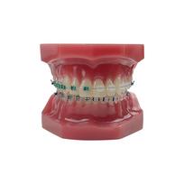 Normal Dental Orthodontic Teeth Model With Brace Half Metal Half Ceramic Standard Teaching Model Dental Teeth Model For Studying