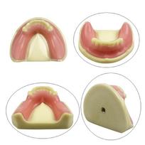 Mandible Maxillary Model For Implant Training Teaching Studying Dentistry Upper Lower Jaws Missing Teeth Implant Practice Model