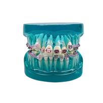 New Dental Orthodontic Treatment Model Standard Teaching Model Dental Teeth Model With Bracket Half Metal Half Ceramic  2 Colors