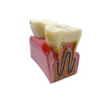 Big Dental Teeth Model Anatomy Large Dental Anatomical Model For Teaching Studying Education Demonstration Patient Communication