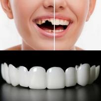 Confident Smile Vintage-Style Dental Grillz for Women - Perfect for Halloween, Christmas & Masquerade Parties