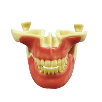 Dental Teeth Implant Practice Model Anchorage Nail Upper Lower Implant Training Model For Teaching Studying Education Display