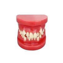 1pcs Dental Model Teeth Malocclusion Model Dentistry Typodont For Teaching Education Demostration Dentist Students Studying Jaws