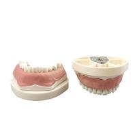 Kids Deciduous Teeth Practice Model With Removable Tooth 24 Teeth Child Primary Tooth Typodont Jaws For Training Teaching Study