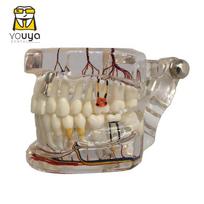 Teeth Neural Repair Dental Implant Pathological Model Dentist Students Communication, Learning, Research Oral Disease Teaching