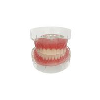 Educational Dental Implant Model Removable 4 Implant Upper Lower Jaw Models Dentist Maxillary Mandibular Overdenture Teeth Model