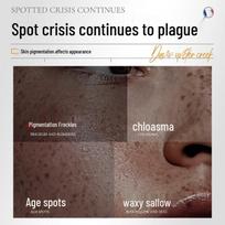Xixia Chenguang Brightening & Spot Correcting Face Cream
