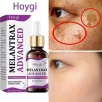 Hoygi Niacinamide Facial Serum Vitamin B3 Anti-Wrinkle Dark Spot Remover Brightening Moisturizer 30ml