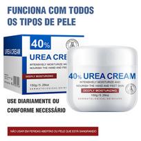 150g Urea Moisturizing Cream 40 Percent, Foot and Hand Care for Dry Cracked Skin - Deep Hydration to Enhance Skin's Defense One Size balta