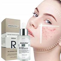 Immetee Retinol serum veidui – regeneracija, kova su aknės randais ir raukšlėmis