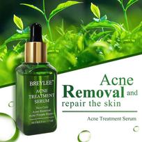 Acne Treatment Essence Tea Tree Oil Clear Skin Essence for Clearing Severe Acne Remover Pimple Repair Skin