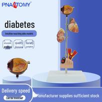 Human Diabetes Complications Model: Eyes, Heart, Kidneys, Blood Vessels, Foot, Orthopedics, Rehabilitation, Pathology PVC Material