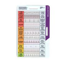 Yousheng 1/2 vnt. EKG ritmo kišeninė kortelė Dvišalė EKG ritmo interpretacijos referencinė kortelė Nešiojama EKG ritmo ženklelio kortelė Slaugytojų EKG 1pc