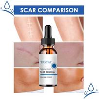 Kremas Odos Žaizdų Kremas Degantis Išblukimas Kremas Chirurgija Randų odos priežiūra Odos balinimo kremas crema para manchas de la cara 5ml