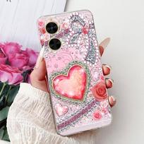 For Xiaomi Redmi A5 4G Case Cute Cat Fashion Painted Cover Soft Slim Phone Cases For Xiaomi Poco C71 C 71 PocoC71 RedmiA5 Fundas Xiaomi Redmi A5