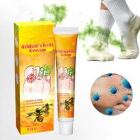 Household Foot Odor Cream Ointment Foot Care Discomfort Care Foot Exercise Foot Sweat Odor Cleaning And Refreshing. geltona