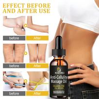 5ml/15ml/30ml/50ml eteriniai aliejai liekninantis aliejus imbiero eterinis aliejus svorio metimui riebalus deginantis aliejus juosmens kojos pilvo masazas 5ml