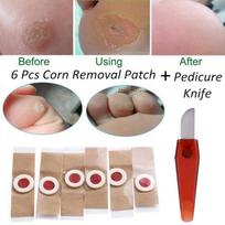 6 vnt./komplektas Foot Corn Removal Killer Calluses Plantar