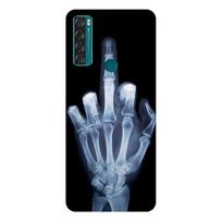 TCL 20 SE dėklas 20B 20L+ 20S silikoninis galinis telefono dėklas, skirtas TCL 20 SE T671H minkštas dėklas, skirtas TCL 20SE Fundas Cartoon Coque TCL 20B