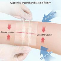 2 vnt./dėžutė Užtrauktuko kaklaraištis Žaizdos uždarymo pleistras Elastinga juosta Greitas siūlas Hemostatinis pleistras Odos priežiūra Dezinfekuojantis pleistras Lauke Nešiojamas white