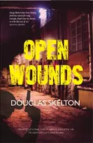 KNYGA Douglas Skelton Open Wounds