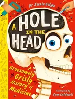 KNYGA Suzie Edge Hole in the Head, A gruesomely grisly history of medical firsts