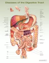 KNYGA Diseases of the Digestive Tract Anatomical Chart