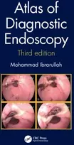 KNYGA Mohammad Ibrarullah Atlas of Diagnostic Endoscopy, 3E