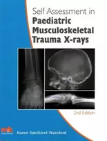 KNYGA Karen Sakthivel Wainford Self-Assessment in Paediatric Musculoskeletal Trauma X-Rays