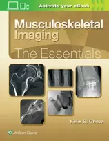 KNYGA Felix S. Chew MD Musculoskeletal Imaging: The Essentials