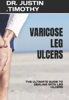 KNYGA Bookshop Varicose Leg Ulcers