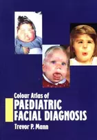 KNYGA Trevor P Mann Colour Atlas of Paediatric Facial Diagnosis