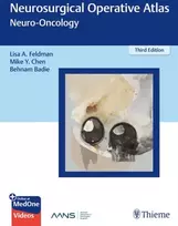 KNYGA Behnam Badie Neurosurgical Operative Atlas: Neuro-Oncology