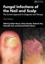 KNYGA Robert Baran Fungal Infections of the Nail and Scalp