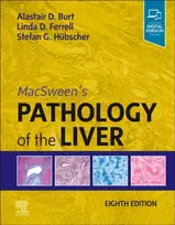 KNYGA Alastair D Burt MacSween's Pathology of the Liver