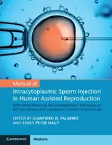KNYGA Gianpiero D Palermo Manual of Intracytoplasmic Sperm Injection in Human Assisted Reproduction