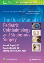 KNYGA Laura Enyedi Duke Manual of Pediatric Ophthalmology and Strabismus Surgery