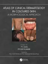 KNYGA P C Das Atlas of Clinical Dermatology in Coloured Skin