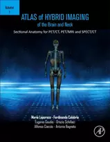 KNYGA Mario Leporace Atlas of Hybrid Imaging Sectional Anatomy for PET/CT, PET/MRI and SPECT/CT Vol. 1: Brain and Neck