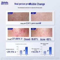 BRODA Salicylic Acid Clarifying & Oil Control Mask