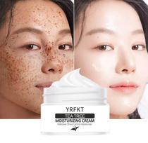 Arbatmedžio drėkinamasis serumas Kremas nuo spuogų susitraukiančias poras Veido kremas Oil Control Hydrate Smooth Repair Skin Care 5G