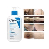 CeraVe Whitening Cream Moisturizing Nourish Repair Improve Arm Armpit Ankles Elbow Knee Body Dull Brighten Arbutin Skin Care 236