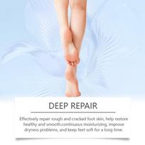 Urea Foot Cream Softens Moisturizes Skin Relieves Dryness Anti Drying Cracked Heel Exfoliates Deeply Penetrates Foot Cream one size