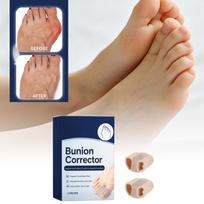 Toe Separators for Pedicure - Soft Silicone Toe Spacers for Nail Polish Application, Comfy Fit Toe Dividers One Size mėlyna
